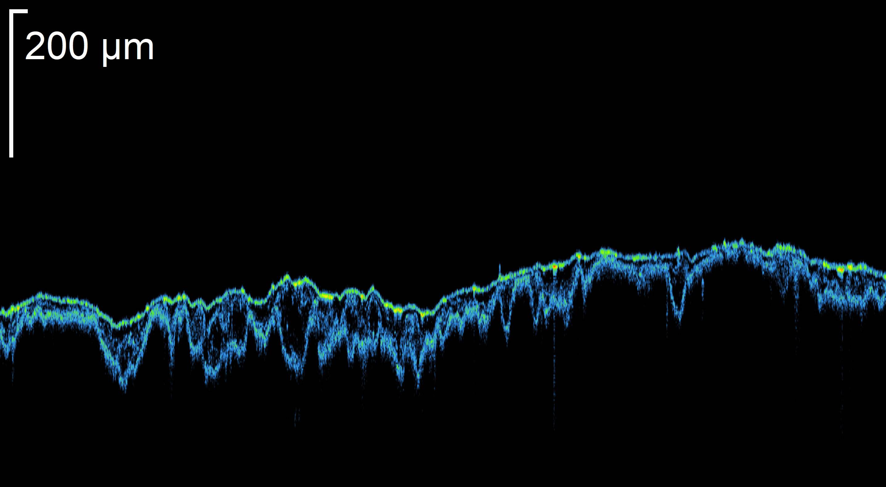 2D/3D analysis