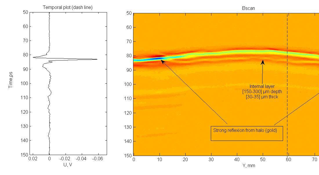 2D/3D analysis